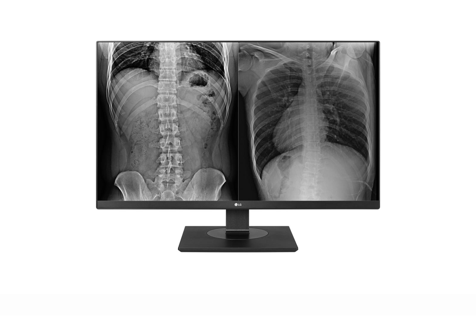 Monitor LG 27" 27HJ713C-B.AEE